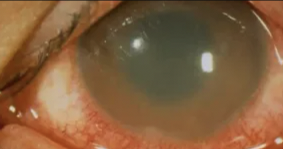 Core Ophthalmic Knowledge for Uveitis